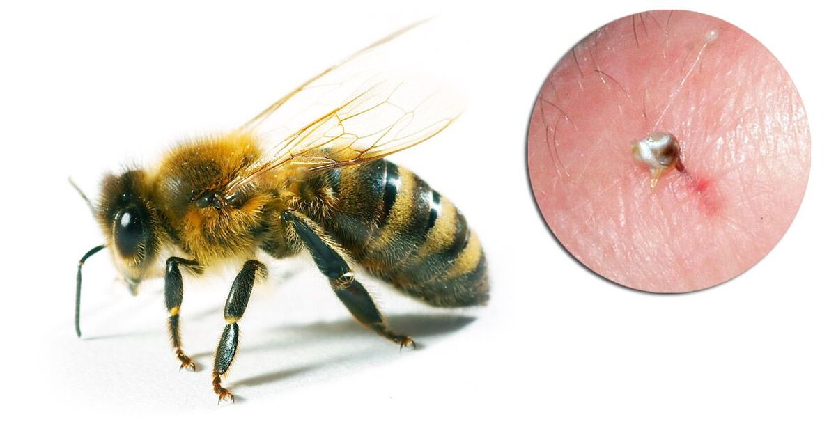 Hondrostrong contient du venin d'abeille, qui améliore les processus métaboliques dans les tissus